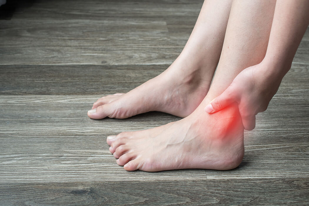 An image of someone suffering from gout - learn how IV hydration therapy with Vida-Flo in Franklin, TN can help.